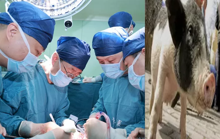 Chinese Physicians Successfully Transplant Pig Liver Into Human Body